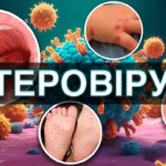 Профілактика ентеровірусної інфекції