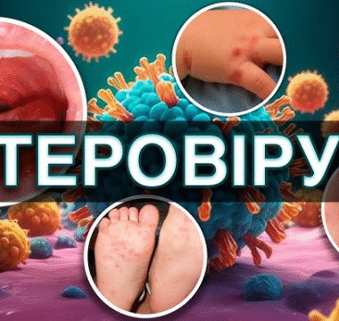 Профілактика ентеровірусної інфекції